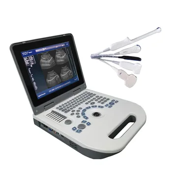 Sustav ultrazvučna dijagnostika laptop HBW-3 Plus Full Digital 2d B/W Prijenosni uređaj za ultrazvučno istraživanja s pisačem